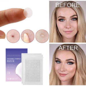 Invisible Salicylic Acid Acne Cover Patches - 72PCS Hide and heal pimples