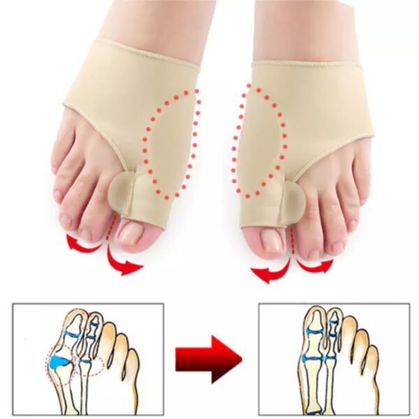Big Toe Straightener 20774