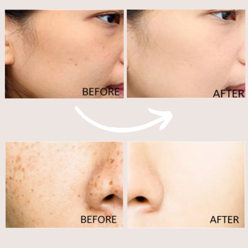 Vitamin C Freckle Cream 20169