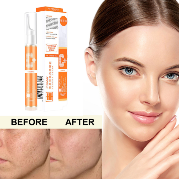 Vitamin C Freckle Cream 20169