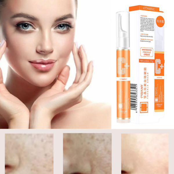 Vitamin C Freckle Cream 20169