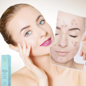 Salicylic Acid Acne Cream 20128