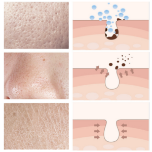 Anti-aging serum for firming and purifying the skin 31031