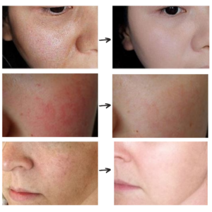 Anti-aging serum for firming and purifying the skin 31031