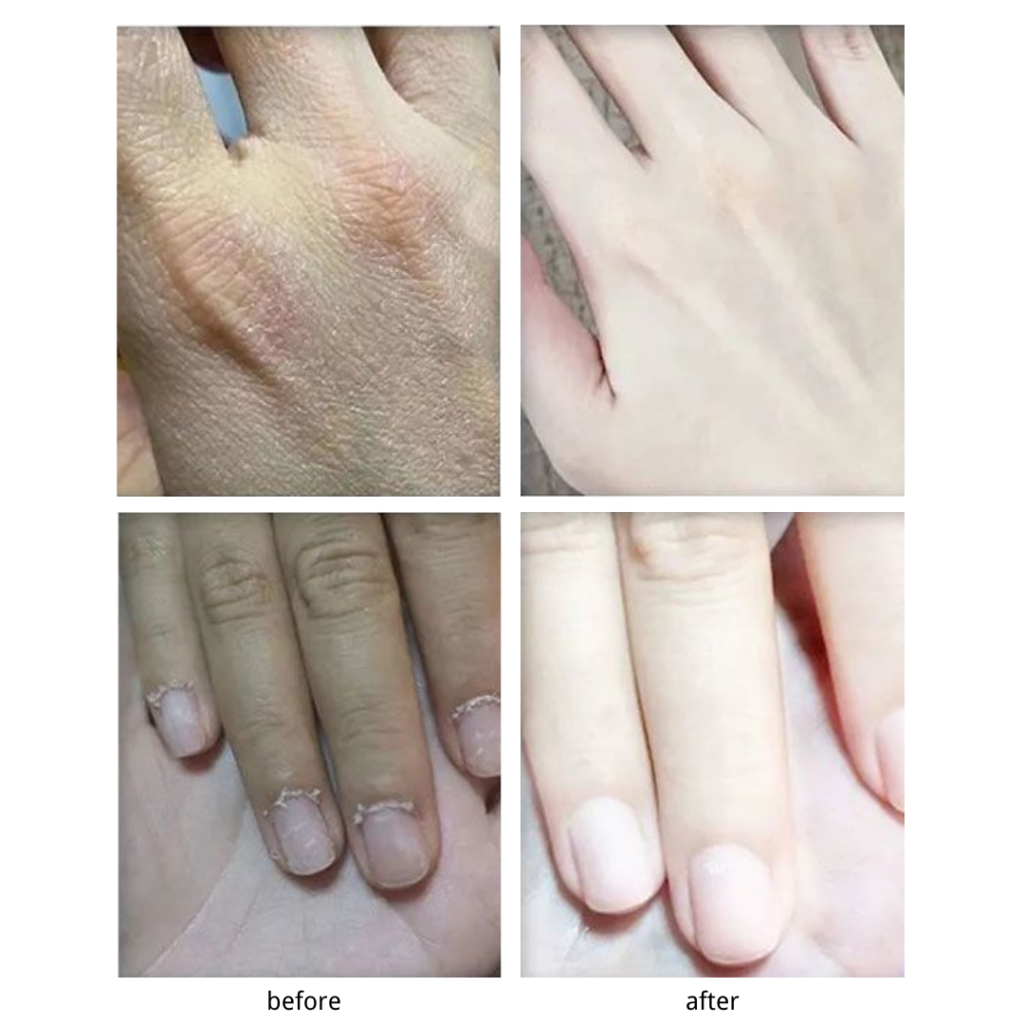 Hyaluronic acid hand cream 20219