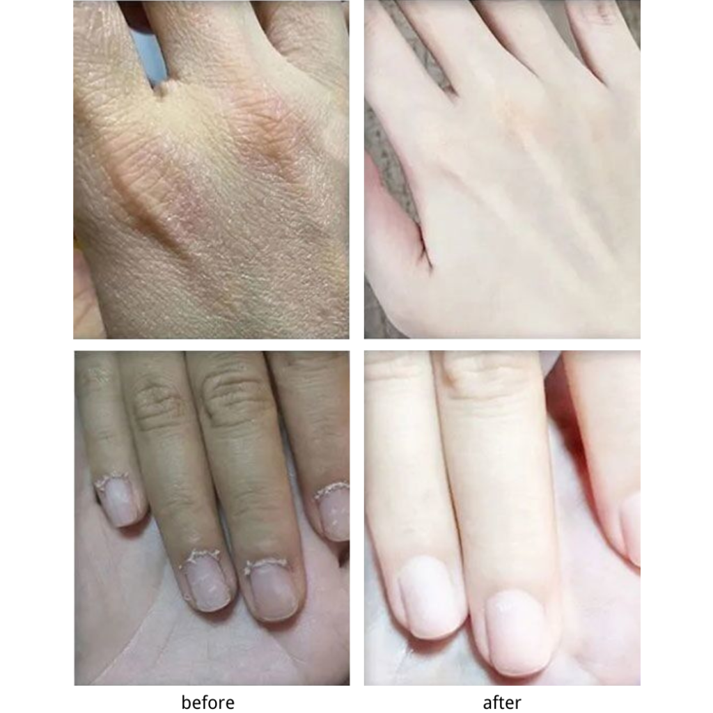 Hyaluronic acid hand cream 20219