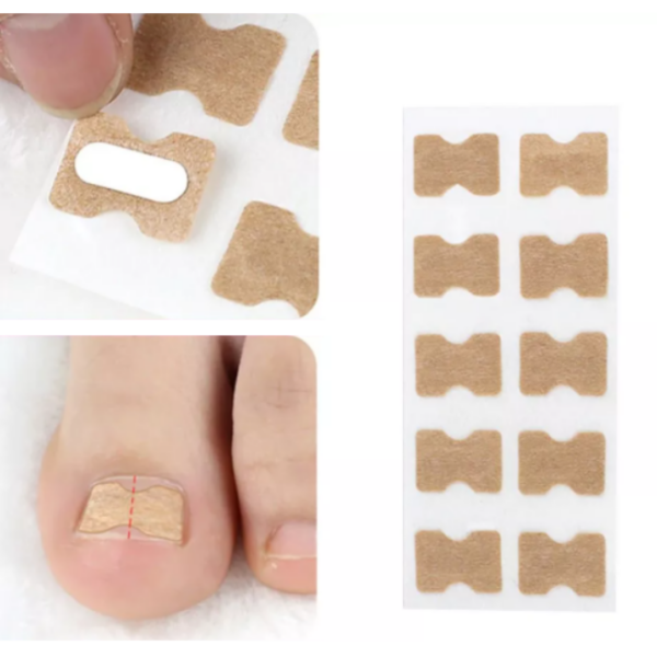 Ingrown toenails patch 20782 (6)