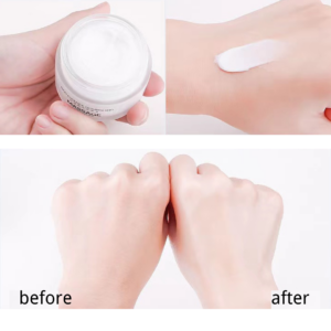 Massage cream for blackheads melasma black joints knees ankles armpits 20512