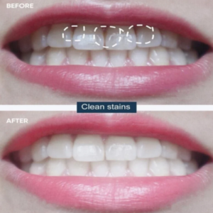 Pressed baking soda whitening mousse 20422