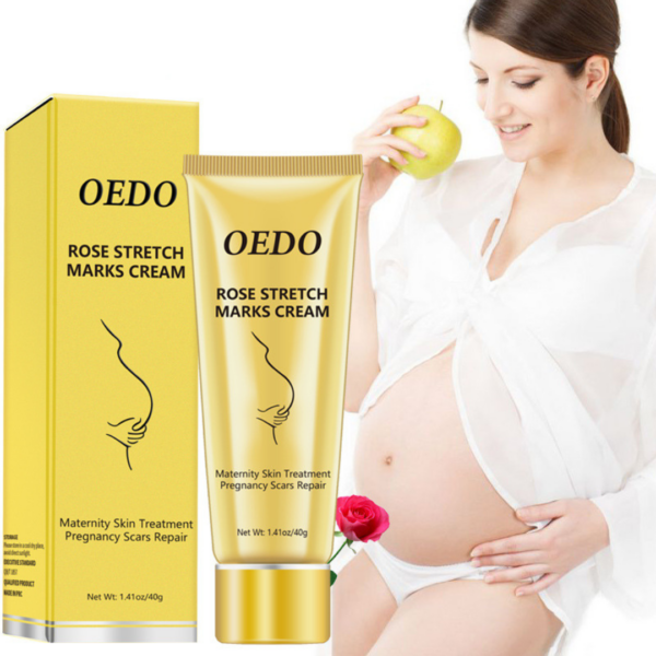 Stretch mark repair 31813