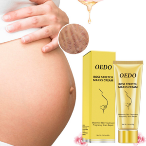 Stretch mark repair 31813