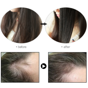 ultra boost hair care set -shampoo soap Argan hair serum and conditioner hair regrowth 32205