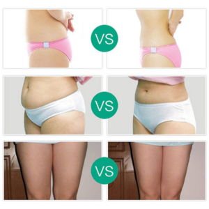 Body Slimming Fat-burning Cream 20612