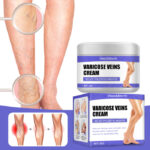 varicose veins cream 20176