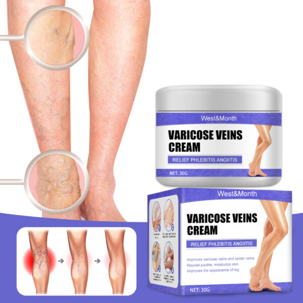 varicose veins cream 20176