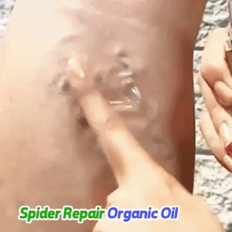 varicose veins cream 20176