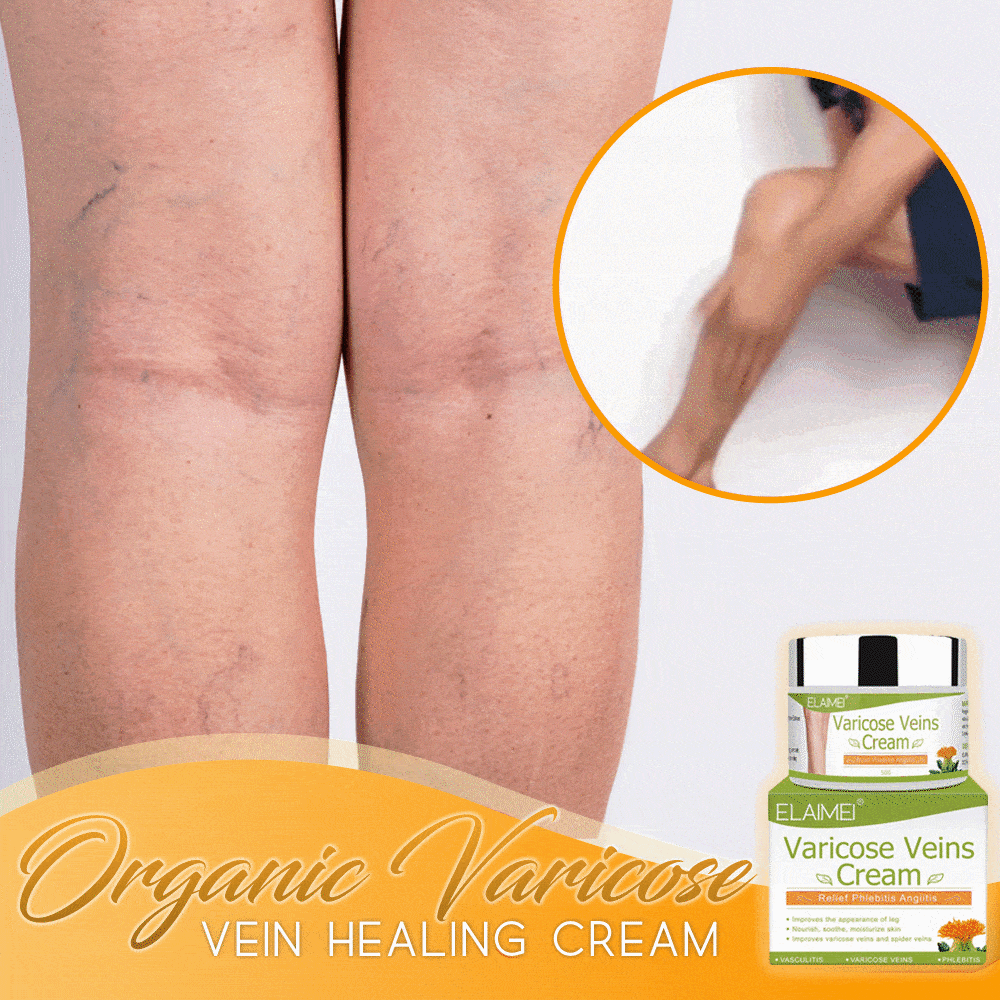 Varicose Veins Cream 10440
