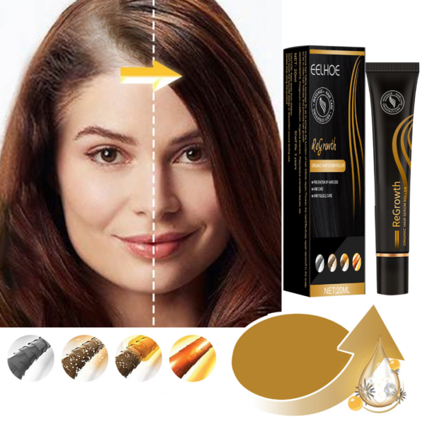 mesotherapy preparation for preventing hair 22026