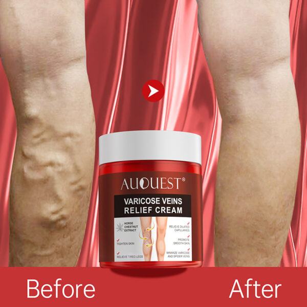Varicose Veins Relief Cream Safe And Effective 80G