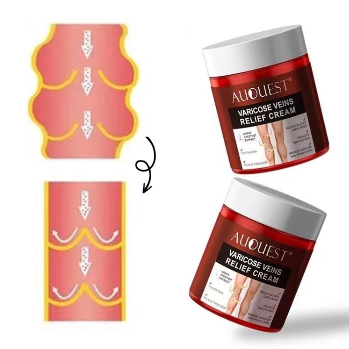 varicose veins relief cream safe and effective 10302